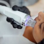 What is RF Microneedling and How Does It Work